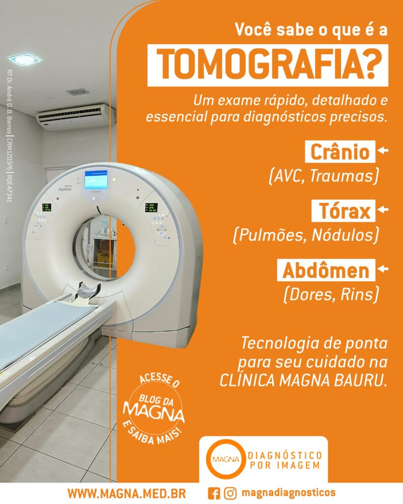 O que é a Tomografia Computadorizada